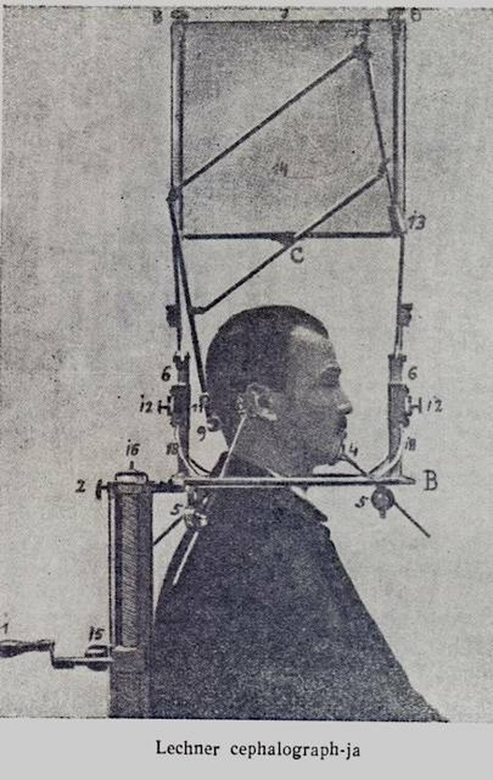 Lechner Károly Cephalograph-ja (koponyamérő) (Balázs-Spielmann, 1956)
